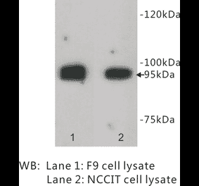Western Blot - Anti-LGR5 Antibody (BPA1071) - Antibodies.com