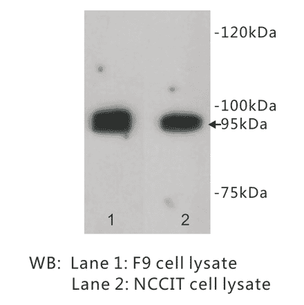 Western Blot - Anti-LGR5 Antibody (BPA1071) - Antibodies.com