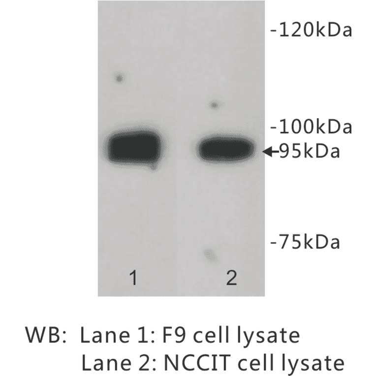 Western Blot - Anti-LGR5 Antibody (BPA1071) - Antibodies.com
