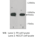 Western Blot - Anti-LGR5 Antibody (BPA1071) - Antibodies.com