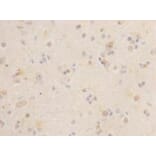Immunohistochemistry - Anti-LGR5 Antibody (BPA1071) - Antibodies.com
