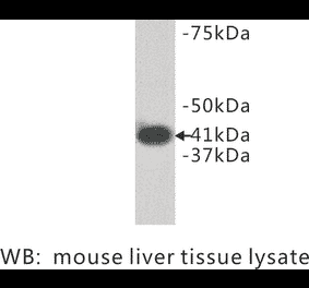 Western Blot - Anti-LPAR1 Antibody (BPA1072) - Antibodies.com