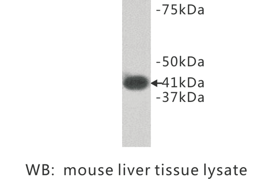 Western Blot - Anti-LPAR1 Antibody (BPA1072) - Antibodies.com