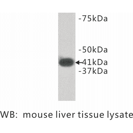 Western Blot - Anti-LPAR1 Antibody (BPA1072) - Antibodies.com