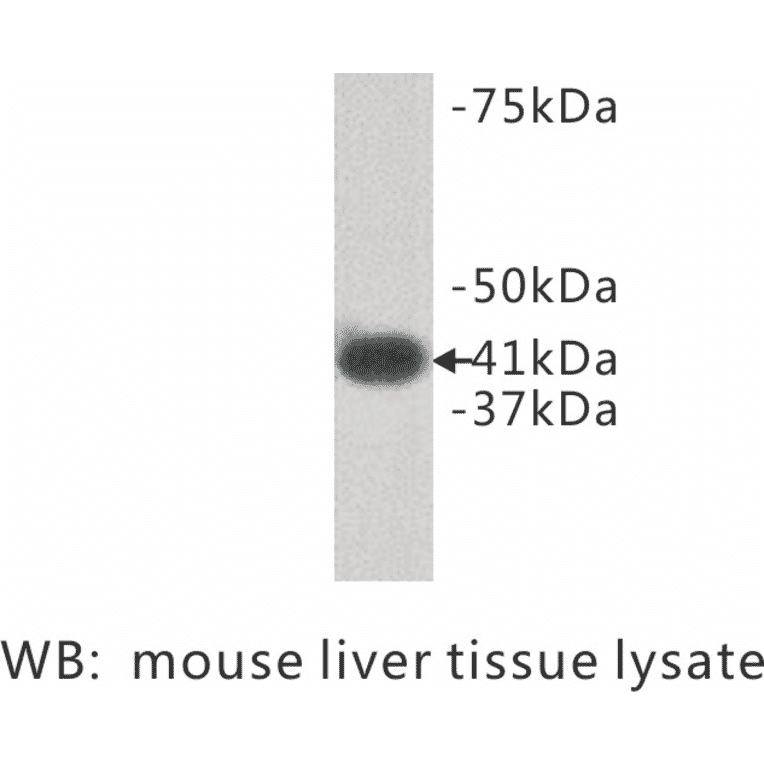 Western Blot - Anti-LPAR1 Antibody (BPA1072) - Antibodies.com