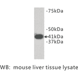 Western Blot - Anti-LPAR1 Antibody (BPA1072) - Antibodies.com