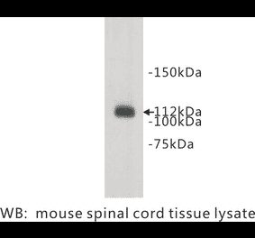 Western Blot - Anti-Meckelin Antibody (BPA1075) - Antibodies.com