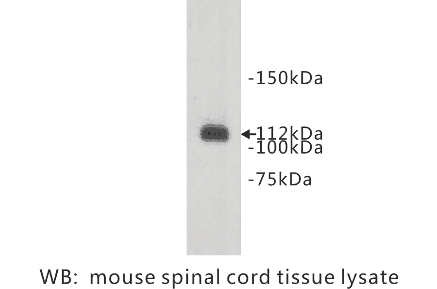 Western Blot - Anti-Meckelin Antibody (BPA1075) - Antibodies.com