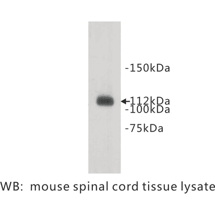 Western Blot - Anti-Meckelin Antibody (BPA1075) - Antibodies.com