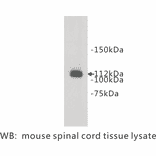 Western Blot - Anti-Meckelin Antibody (BPA1075) - Antibodies.com