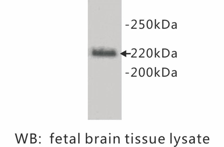 Western Blot - Anti-L1CAM Antibody (BPA1078) - Antibodies.com