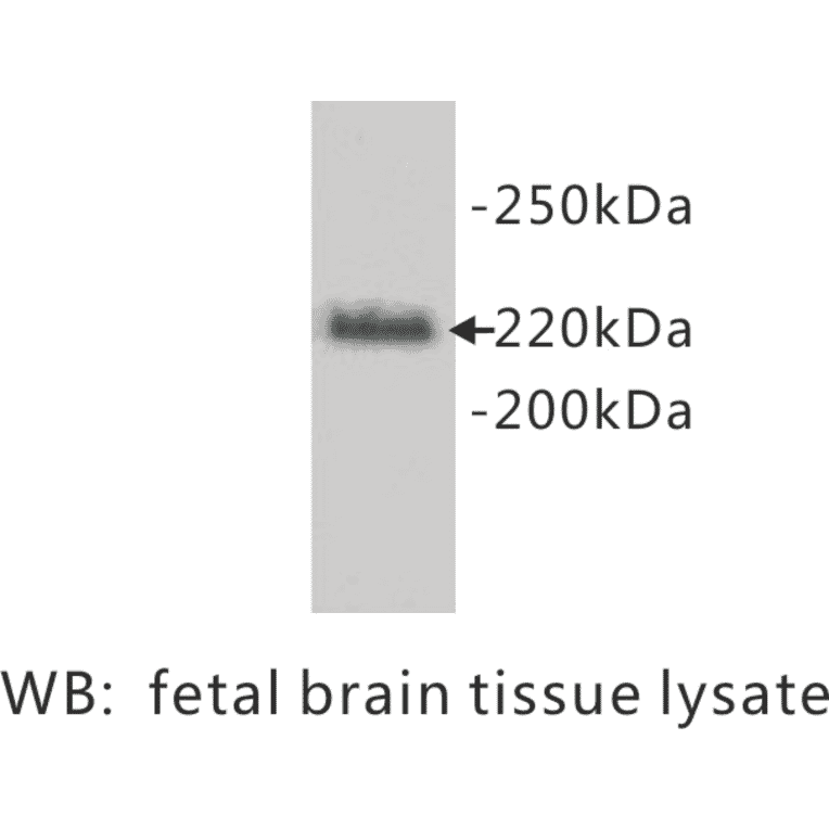 Western Blot - Anti-L1CAM Antibody (BPA1078) - Antibodies.com