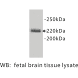 Western Blot - Anti-L1CAM Antibody (BPA1078) - Antibodies.com