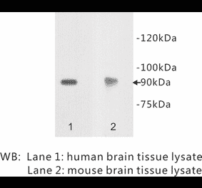 Western Blot - Anti-Netrin receptor DCC Antibody (BPA1079) - Antibodies.com