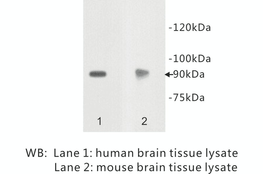 Western Blot - Anti-Netrin receptor DCC Antibody (BPA1079) - Antibodies.com