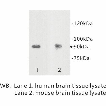 Western Blot - Anti-Netrin receptor DCC Antibody (BPA1079) - Antibodies.com