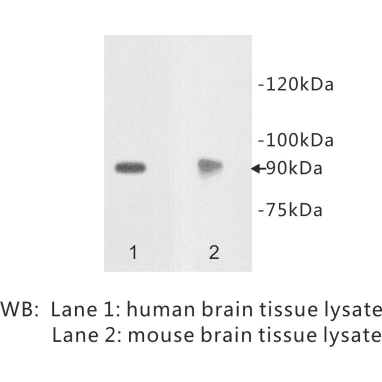Western Blot - Anti-Netrin receptor DCC Antibody (BPA1079) - Antibodies.com