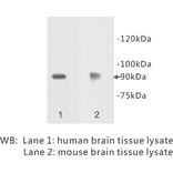 Western Blot - Anti-Netrin receptor DCC Antibody (BPA1079) - Antibodies.com
