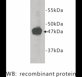 Western Blot - Anti-Neuropilin 1 Antibody (BPA1080) - Antibodies.com