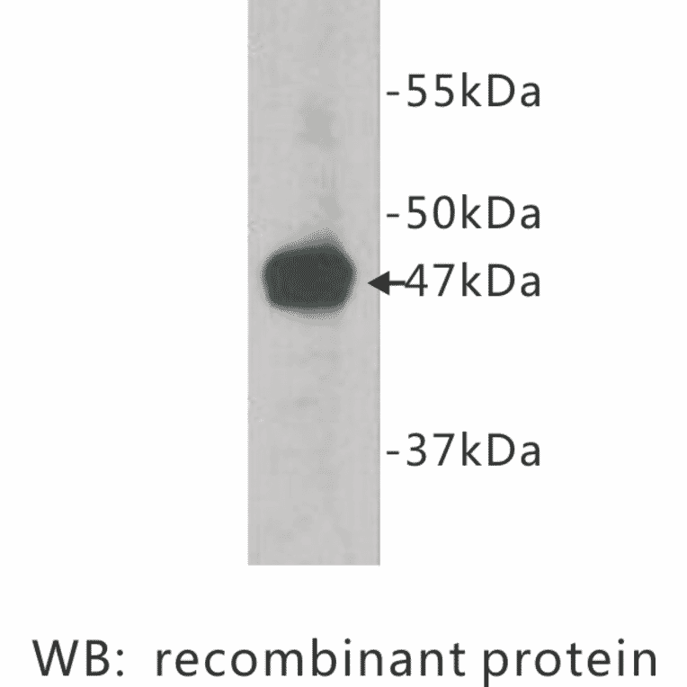 Western Blot - Anti-Neuropilin 1 Antibody (BPA1080) - Antibodies.com