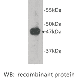 Western Blot - Anti-Neuropilin 1 Antibody (BPA1080) - Antibodies.com