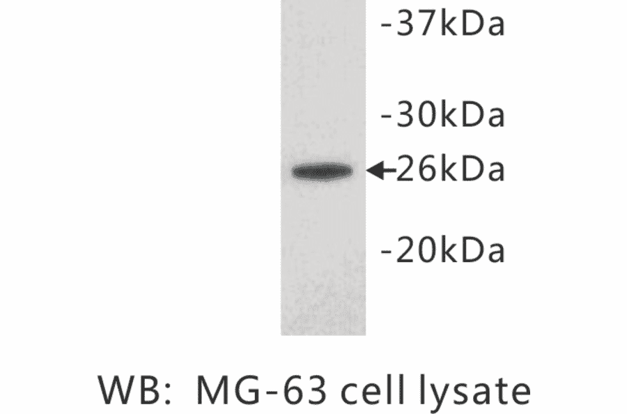 Western Blot - Anti-Noggin Antibody (BPA1081) - Antibodies.com