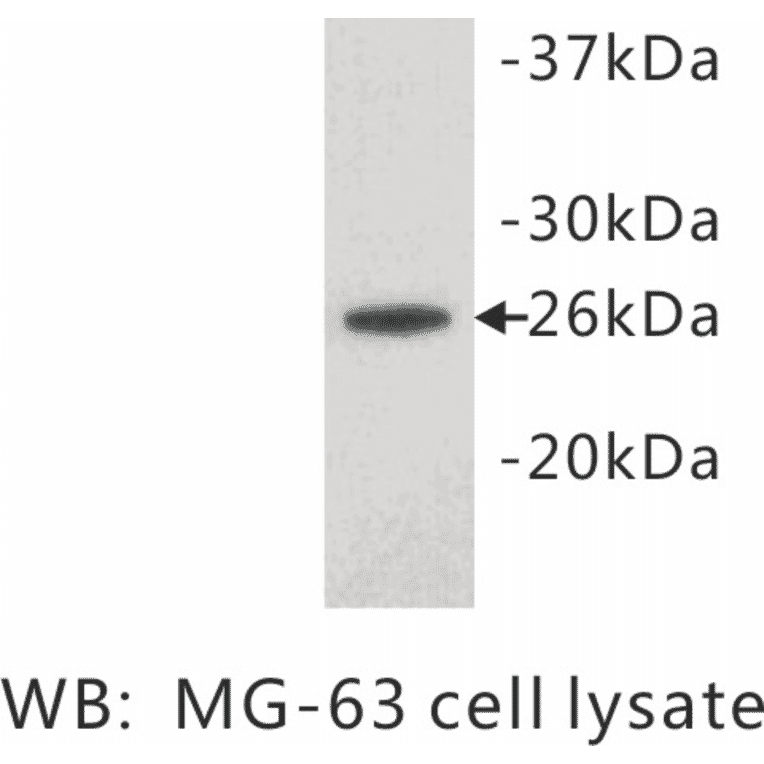 Western Blot - Anti-Noggin Antibody (BPA1081) - Antibodies.com