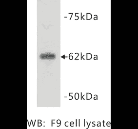 Western Blot - Anti-PGBD5 Antibody (BPA1085) - Antibodies.com