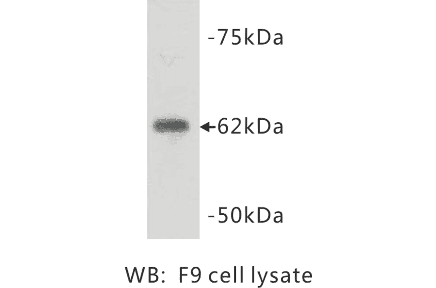 Western Blot - Anti-PGBD5 Antibody (BPA1085) - Antibodies.com