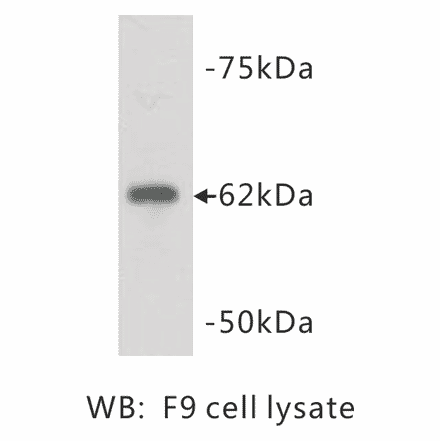Western Blot - Anti-PGBD5 Antibody (BPA1085) - Antibodies.com