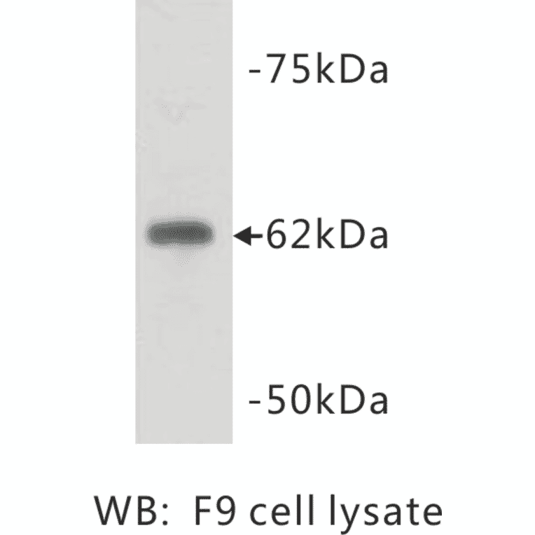 Western Blot - Anti-PGBD5 Antibody (BPA1085) - Antibodies.com