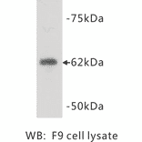 Western Blot - Anti-PGBD5 Antibody (BPA1085) - Antibodies.com