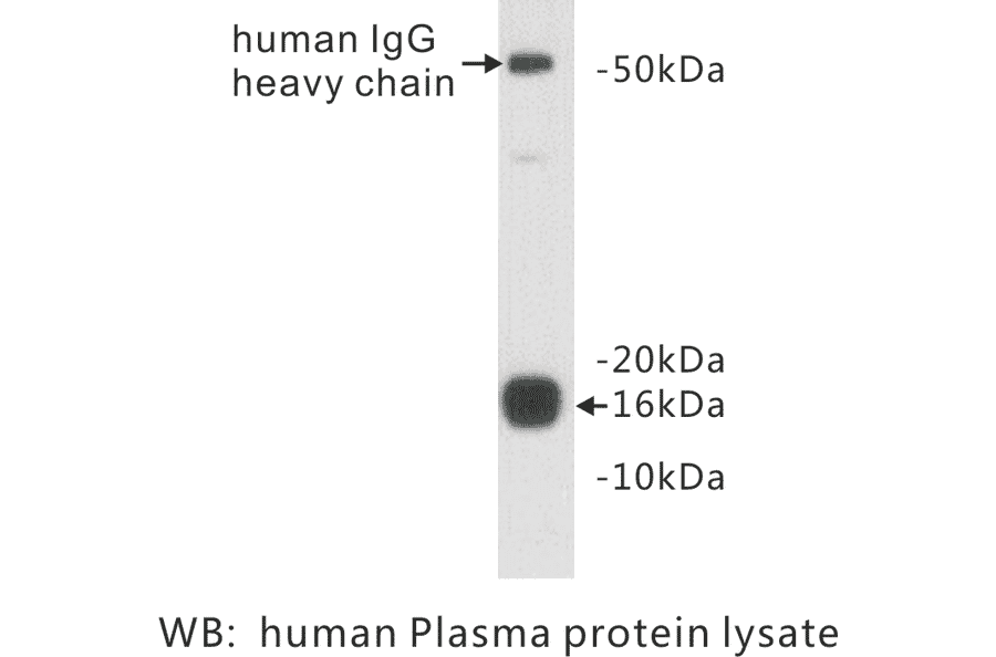 Western Blot - Anti-Prealbumin Antibody (BPA1086) - Antibodies.com