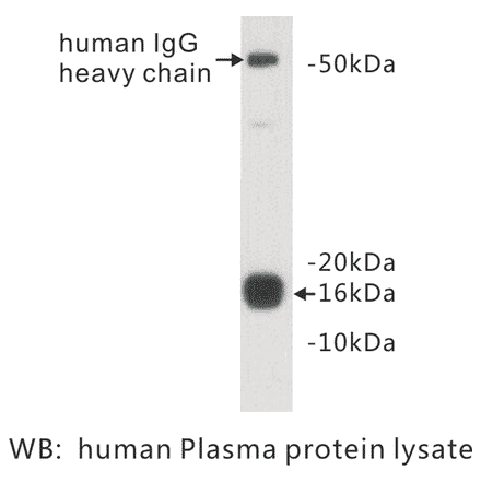 Western Blot - Anti-Prealbumin Antibody (BPA1086) - Antibodies.com