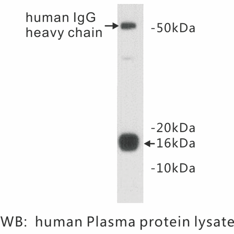 Western Blot - Anti-Prealbumin Antibody (BPA1086) - Antibodies.com