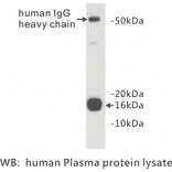 Western Blot - Anti-Prealbumin Antibody (BPA1086) - Antibodies.com