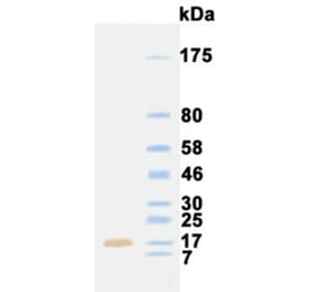 Western Blot - Anti-Fibroblast Growth Factor 1 Antibody (031113E03) - Antibodies.com