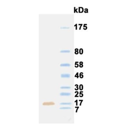 Western Blot - Anti-Fibroblast Growth Factor 1 Antibody (031113E03) - Antibodies.com