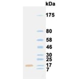 Western Blot - Anti-Fibroblast Growth Factor 1 Antibody (031113E03) - Antibodies.com