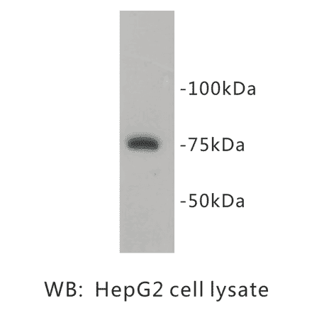 Western Blot - Anti-PRMT5 Antibody (BPA1087) - Antibodies.com