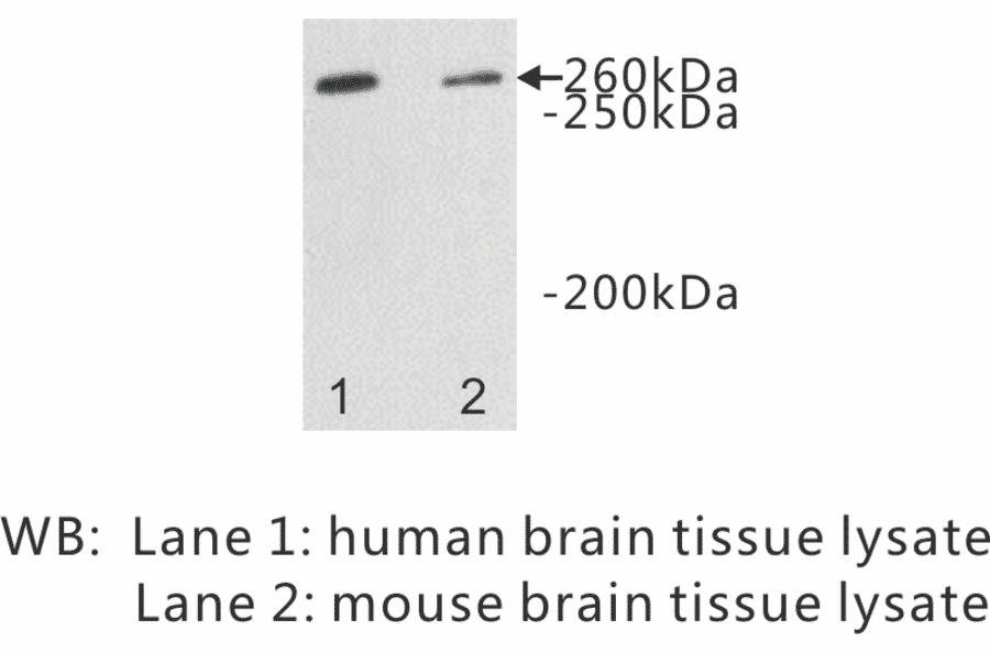 Western Blot - Anti-DOPEY2 Antibody (BPA1088) - Antibodies.com