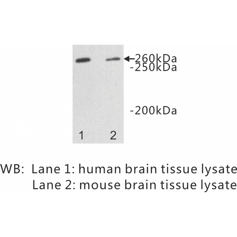 Western Blot - Anti-DOPEY2 Antibody (BPA1088) - Antibodies.com