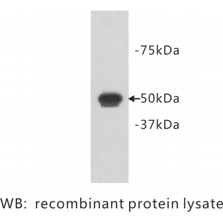 Western Blot - Anti-FAT1 Antibody (BPA1090) - Antibodies.com