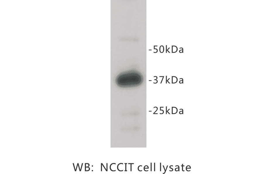 Western Blot - Anti-REM 2 Antibody (BPA1092) - Antibodies.com