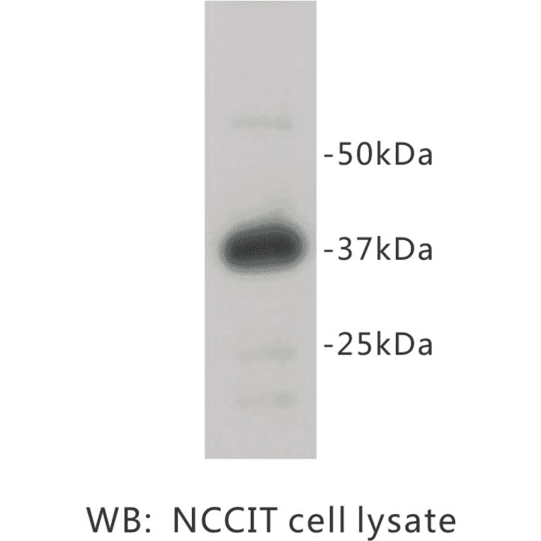 Western Blot - Anti-REM 2 Antibody (BPA1092) - Antibodies.com