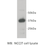 Western Blot - Anti-REM 2 Antibody (BPA1092) - Antibodies.com