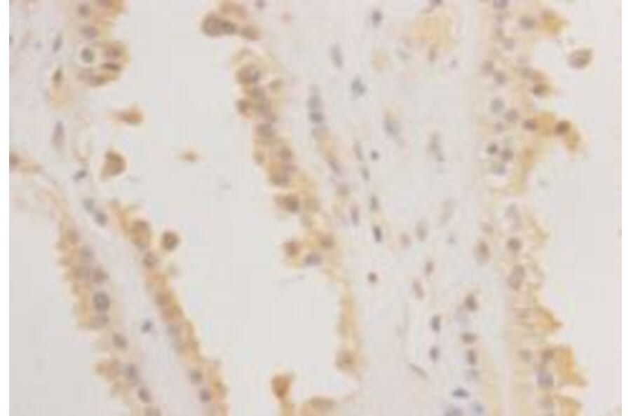 Immunohistochemistry - Anti-REM 2 Antibody (BPA1092) - Antibodies.com