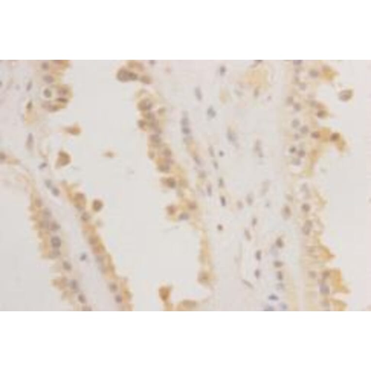 Immunohistochemistry - Anti-REM 2 Antibody (BPA1092) - Antibodies.com
