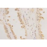 Immunohistochemistry - Anti-REM 2 Antibody (BPA1092) - Antibodies.com