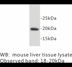Western Blot - Anti-SCA1 Antibody (BPA1093) - Antibodies.com